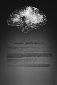 瞑想は脳内の島皮質の促通と脳細胞の遠隔の共鳴が見つかった