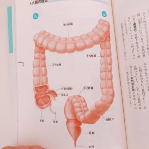 大腸画像